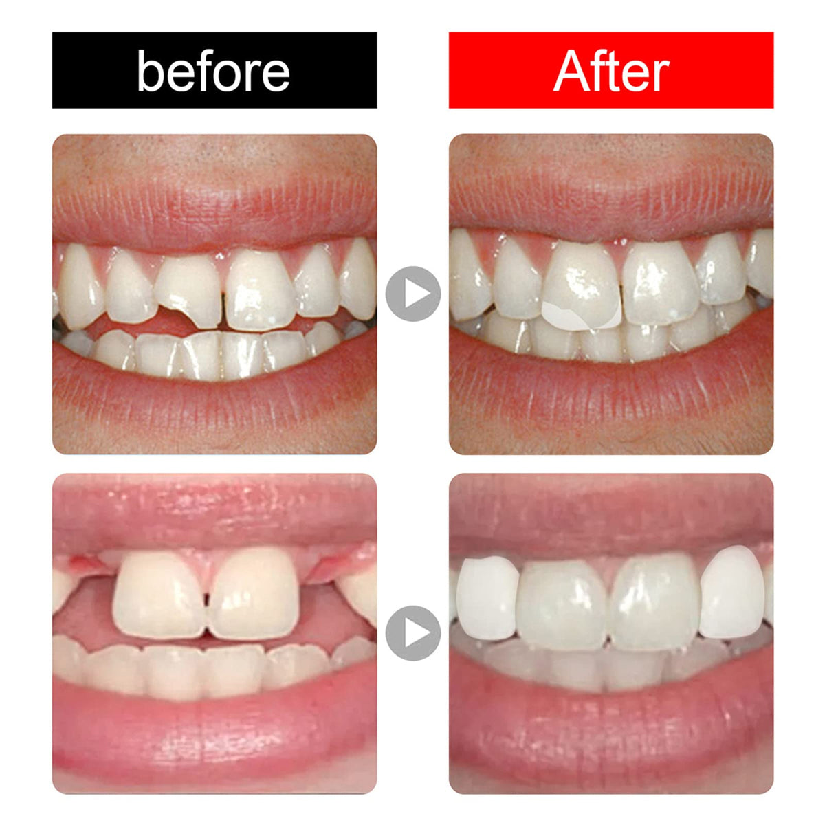 168 Pieces Acrylic Resin Denture Teeth 6 Sets 23 Shade A2 Upper + Lower L45497